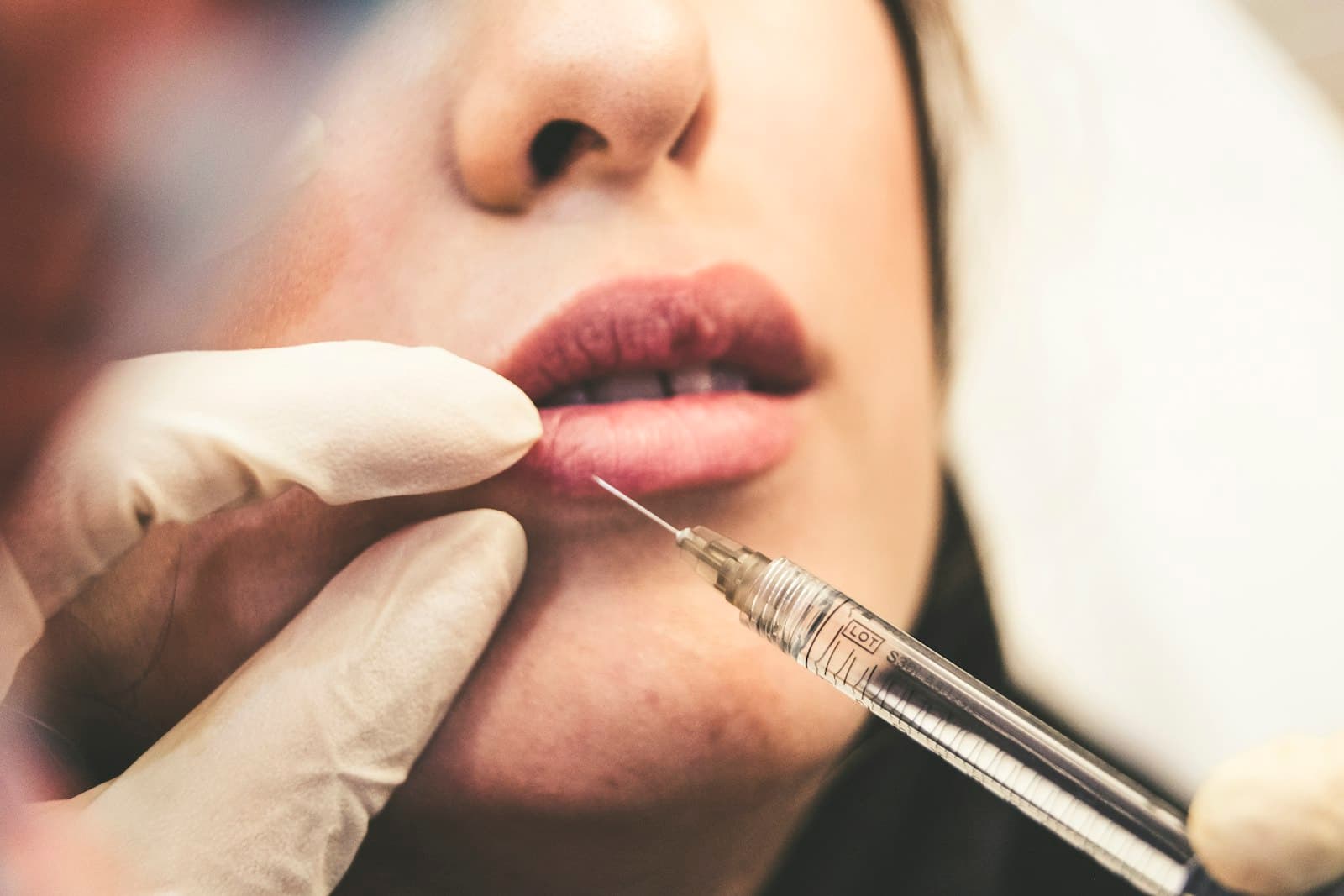 Aumento de labios